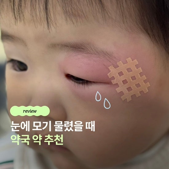 20개월 아기 모기 물렸을 때 | 알러지에 효과 좋은 약 추천 세노바시럽