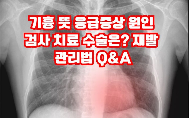 폐 기흉 뜻 응급증상 원인 검사 치료 수술은 꼭 하나? 재발 관리법 Q&A