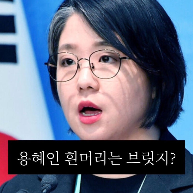 "브릿지 염색 아닙니다".. 용혜인 흰머리로 본 30대 유전성 새치 관리법