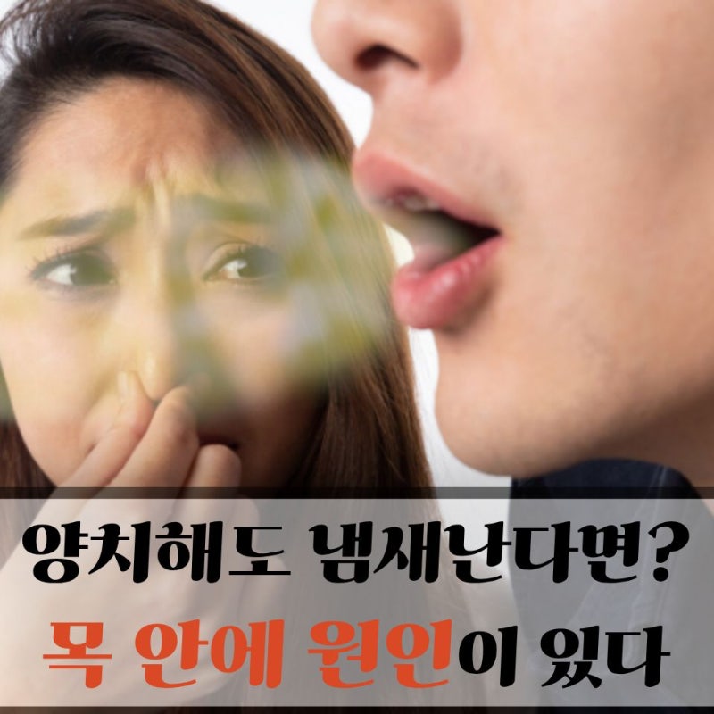"입냄새 때문에 사람 만날 때마다 신경 쓰여.." 이비인후과 전문의가 알려주는 편도결석 빼는....