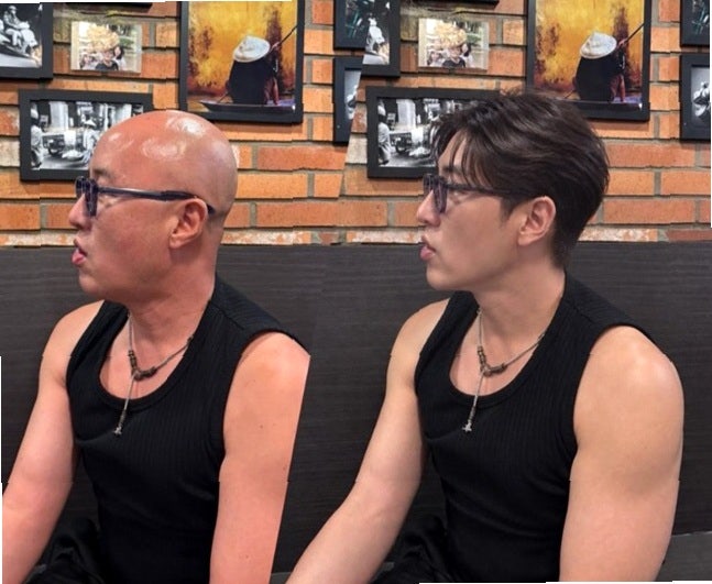 "순간 배우인 줄 알았잖아요..." 홍석천, 가발 착용 반전 모습 속 숨겨진 도파민의 비밀