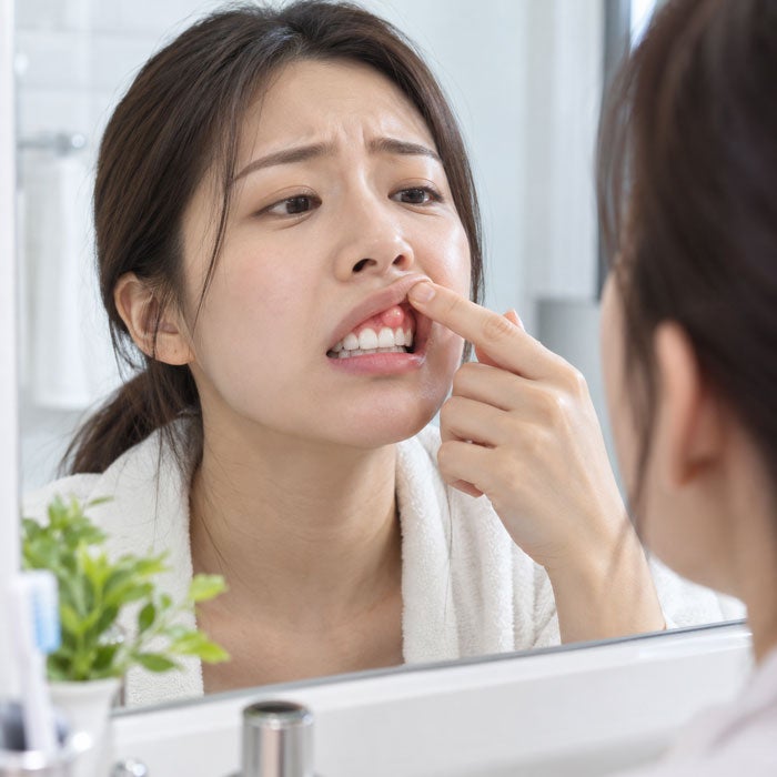 잇몸에 혹 같은 것, 단순 염증일까? 고름주머니처럼 볼록하다면