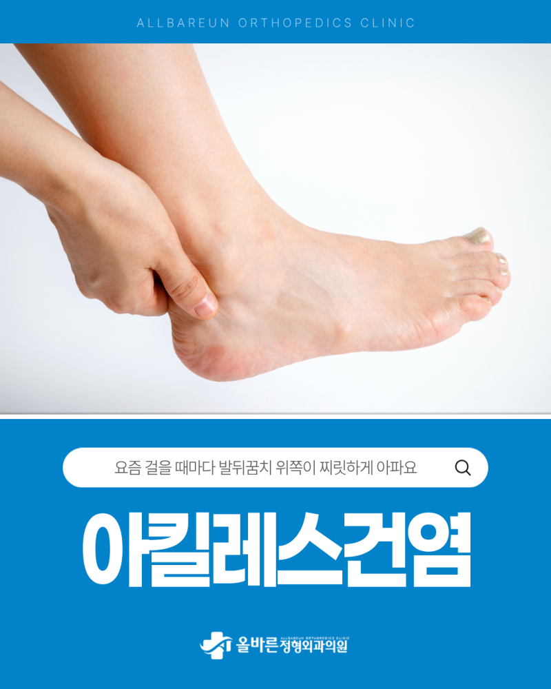 발뒤꿈치 위쪽 당김 통증, 아킬레스건 부음 원인은 아킬레스건염?