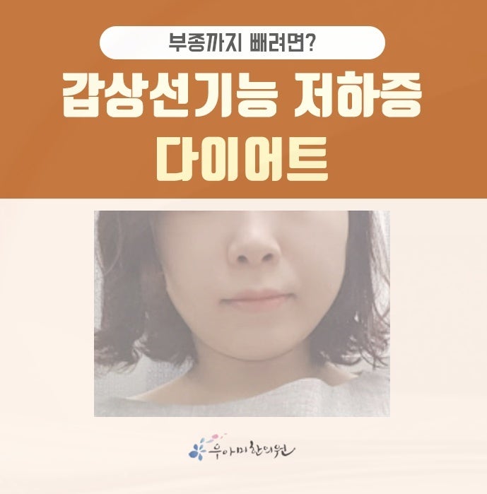 갑상선기능저하증 다이어트｜TSH·FT4 결과를 체중과 함께 읽는 법