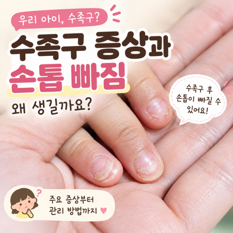 수족구 후 손톱 빠짐 괜찮을까? 손발톱 탈락 원인과 관리법