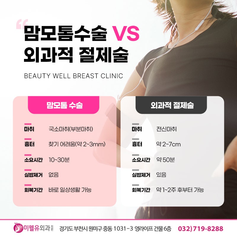 인천외과 추천, 맘모톰수술 언제 필요할까?