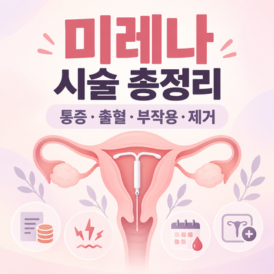 미레나 시술 총정리｜가격·통증·부작용·생리 변화·제거