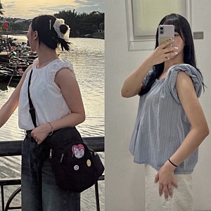 분당 람스가격 얼마일까? 팔뚝 무한람스 통증 멍 붓기 세 달차 후기