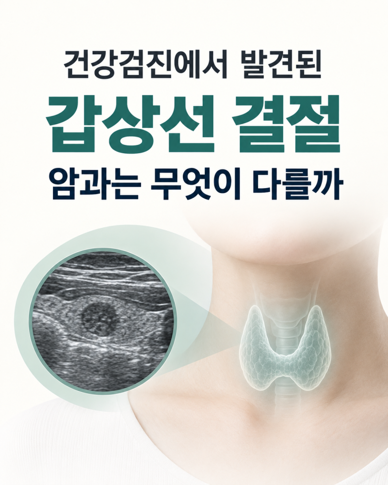 건강검진에서 발견된 갑상선 결절, 암과는 무엇이 다를까