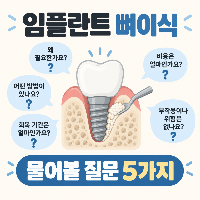 임플란트 뼈이식 추가 견적 받았다면 물어볼 질문 5가지 (자가골·이종골·성공률·회복 기간)
