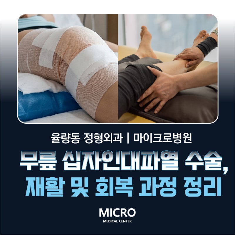 율량동 정형외과 | 무릎 십자인대파열 수술, 마이크로병원의 재활 및 회복 과정 관리
