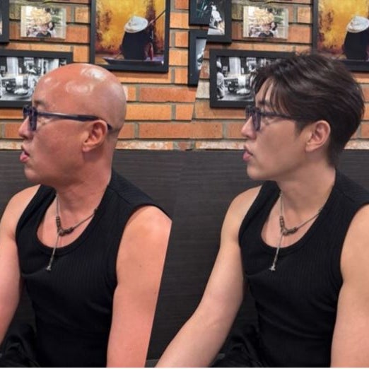 “홍석천 맞아?” 가발 하나 썼을 뿐인데…그가 민머리를 고수한 이유