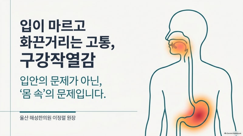 울산 구강작열감, 입이 마르고 떫은 증상이 함께 나타난다면