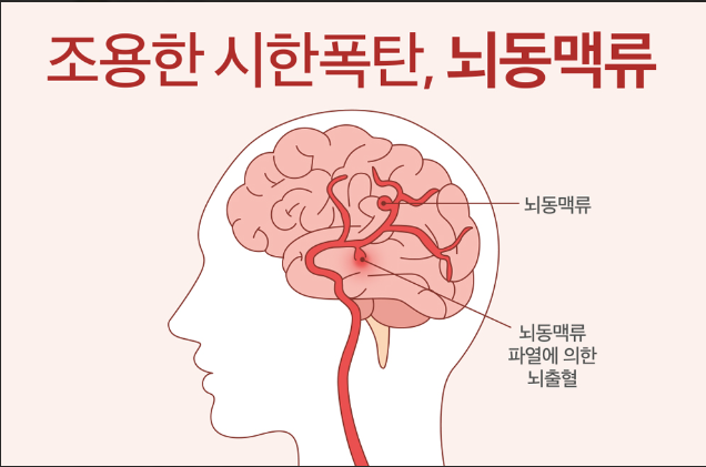 "뇌동맥류와 보험, 발견됐다고 무조건 보험금이 나올까?"