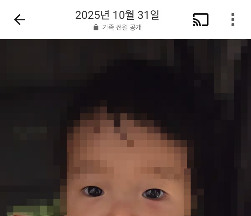 지옥같았던 돌아기 다래끼 l 아기 다래끼 수술 병원찾기, 수술 결정까지