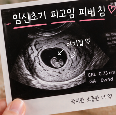 임신초기 피고임 발견 피비침 될 뻔한 경험 입원까지 한 이유