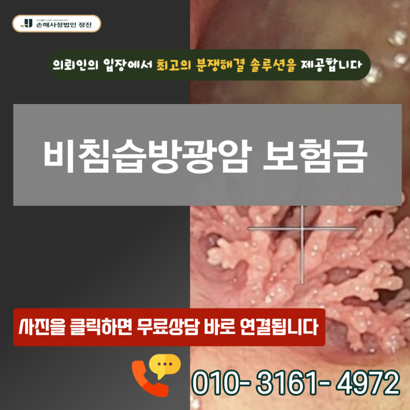 비침습방광암 보험금, C67 코드 받고도 D09 제자리암으로 삭감됐다면 전액 수령 불가능할까?