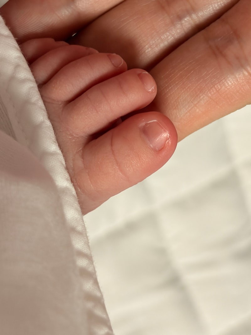 RSV 예방접종 꼭 맞아야할까? 접종시기, 가격 정보