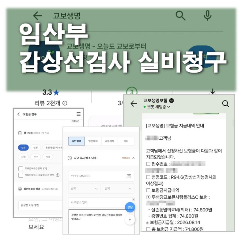 임산부 갑상선 검사 실비 청구 가능할까? 비용 및 청구 후기