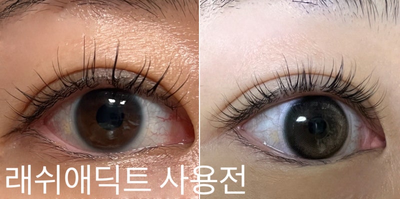 래쉬애딕트 리얼 후기 (1개월~3개월) 속눈썹 생장제 효과 @베어래쉬