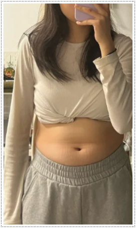 비에날17 유산균 효능 추천 복용법 부작용 내돈내산 후기