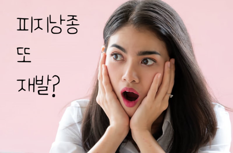 [영등포구] 재발 잦은 피지낭종, 근본적인 제거 치료