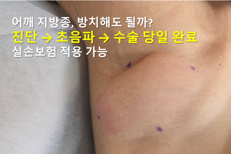 어깨 지방종 제거 수술, 당일 진료부터 수술까지 과정