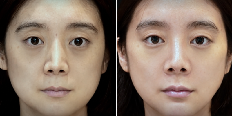 우혜림, 다크서클이 무릎까지 내려왔다더니…컨실러로 안 가려진 진짜 이유｜눈밑 꺼짐·입....
