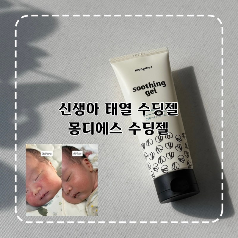 신생아 태열 관리 수딩젤 추천 몽디에스 수딩젤 내돈내산 솔직후기 태열 초기 관리법