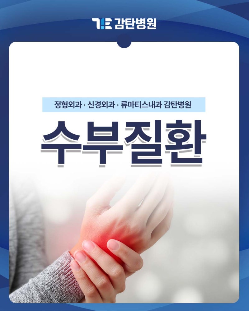 감탄병원 수부질환 종류별 증상과 치료방법 총정리 [대전장대동정형외과]