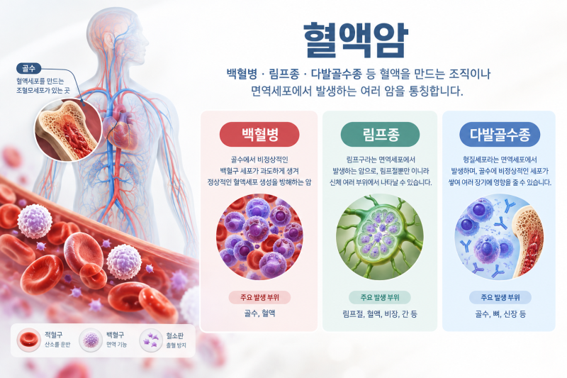 혈액암이란?백혈병·림프종·다발골수종 증상부터 진단과 치료까지 알아보기