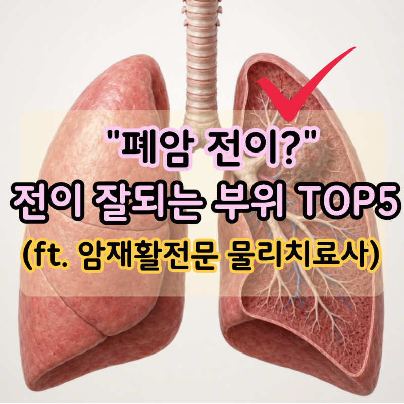 "폐암 전이 잘되는 부위 TOP5" 가장 흔한 곳이 반대쪽 폐가 아니라고?