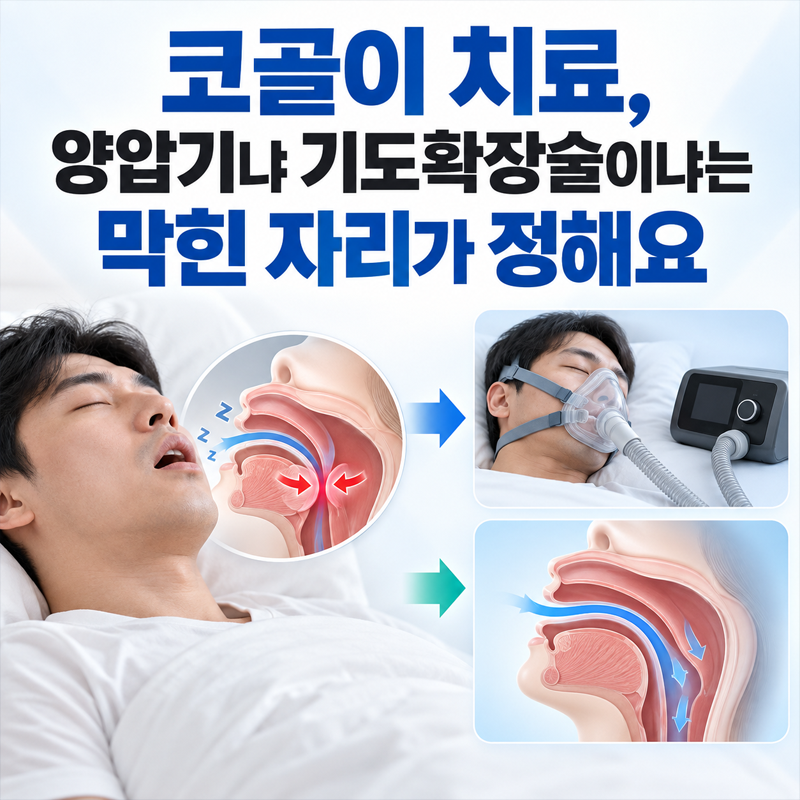 코골이 치료, 양압기냐 기도확장술이냐는 막힌 자리가 정해요