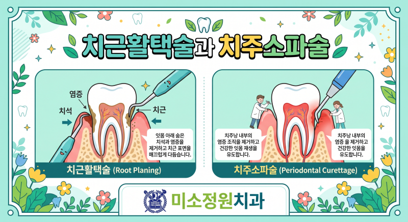 영등포치과 치주치료 치근활택술과 치주소파술이란??