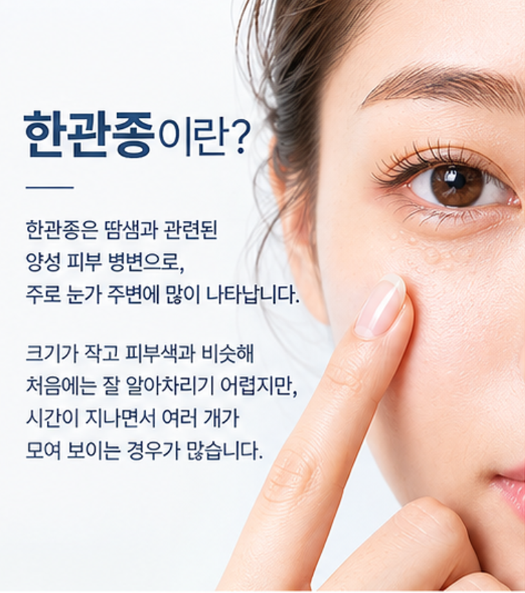 세종 한관종, 눈밑 오돌토돌한 돌기 비립종과 어떻게 다를까요?