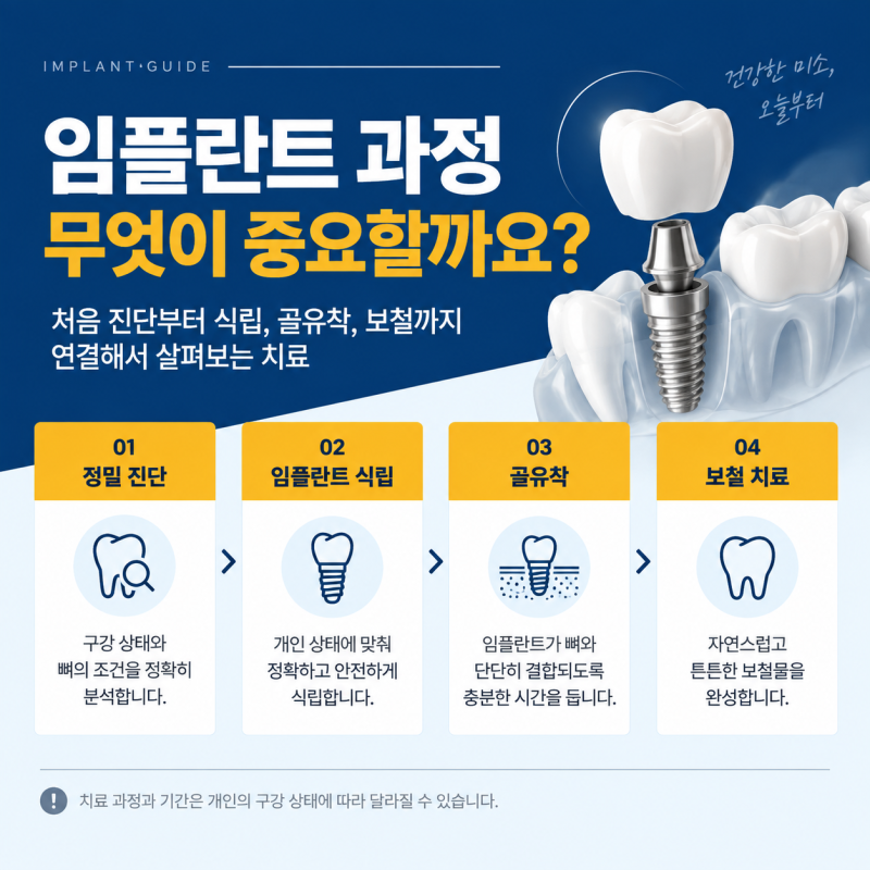 군자역치과 임플란트 과정에서 중요한 점은 무엇일까요?