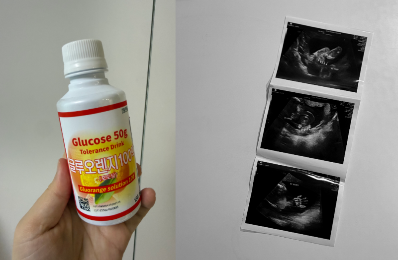임당 재검 금식 검사방법 (검사수치 통과!)