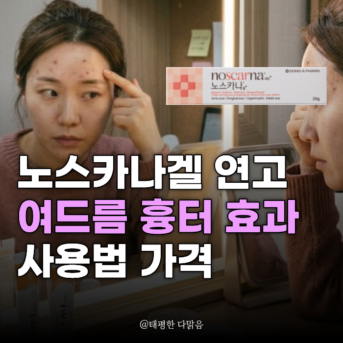노스카나 겔 연고 가격 사용법 여드름 흉터 효과 알아보자