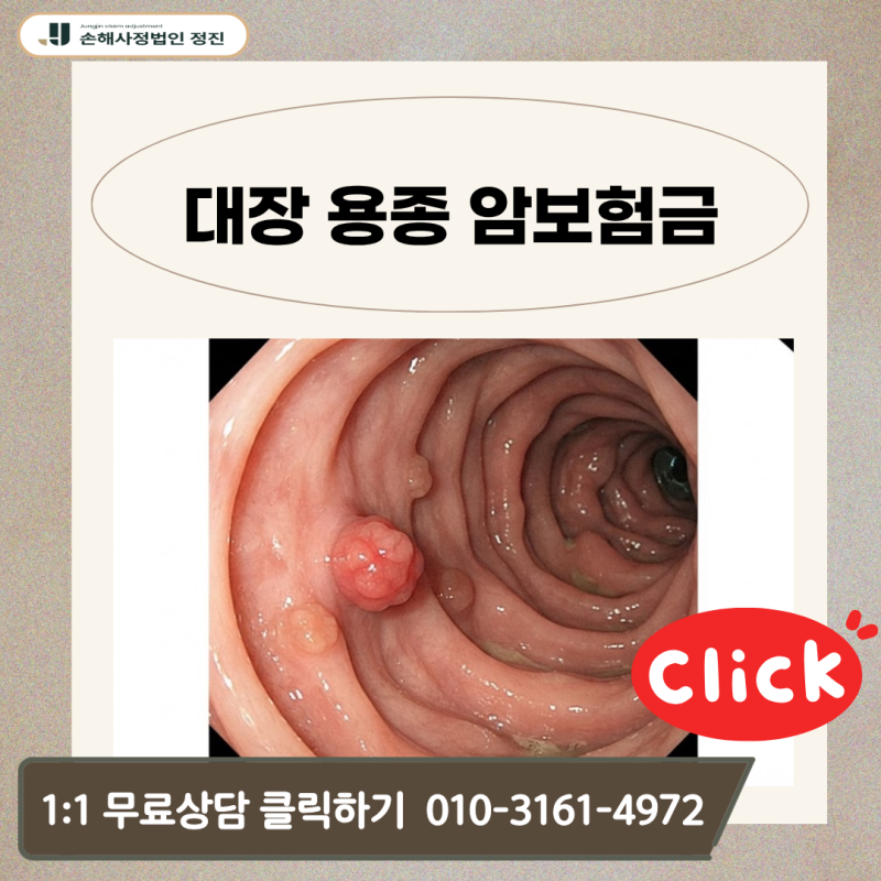 대장 용종 암보험금, D12 코드 받았는데 D01 제자리암으로 받을 수 있을까?