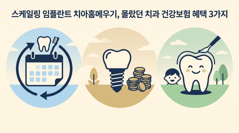스케일링 임플란트 치아홈메우기, 몰랐던 치과 건강보험 혜택 3가지