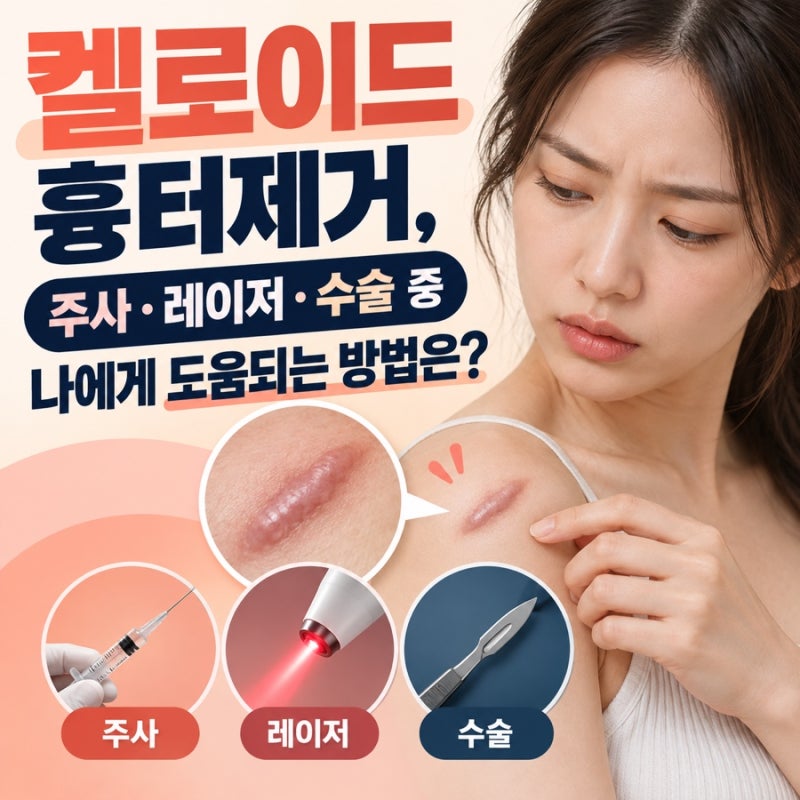켈로이드 흉터제거, 주사·레이저·수술 중 나에게 도움되는 방법은?