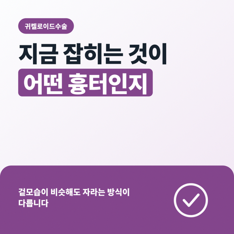 귀켈로이드수술 필요한 흉터 증상인지