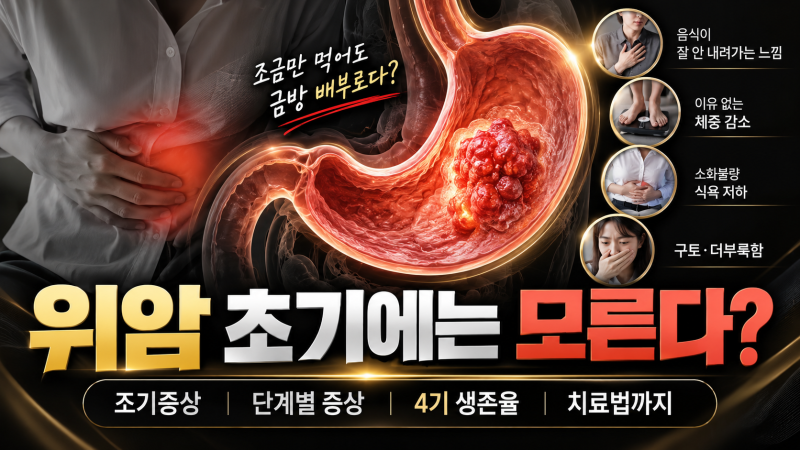 위암 증상 초기에는 모른다? 조기증상부터 단계별 증상·4기 생존율·치료법까지