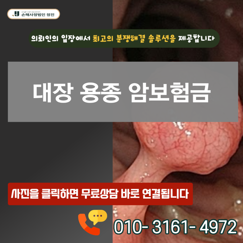 대장 용종 암보험금, D12 코드 받았는데 D01 전액 수령 가능할까요?