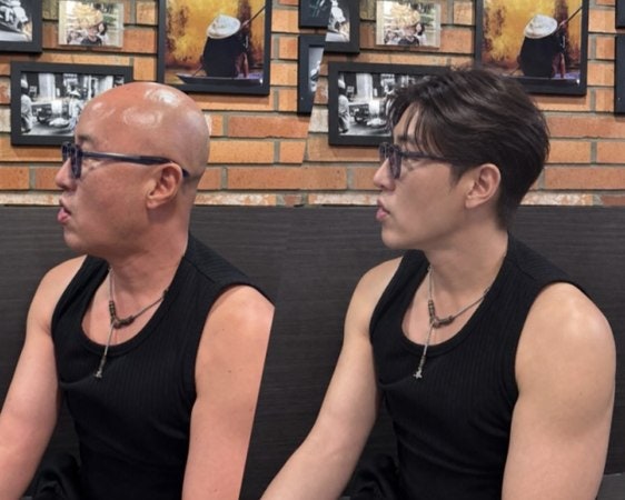 결국 홍석천이 직접 밝힌 정체, "민머리? 가발?" 사진 한 장에 팬들 발칵