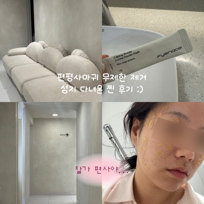 강남역 편평사마귀 무제한 제거, HPV치료 성지 도전 성공 후기 공유 !