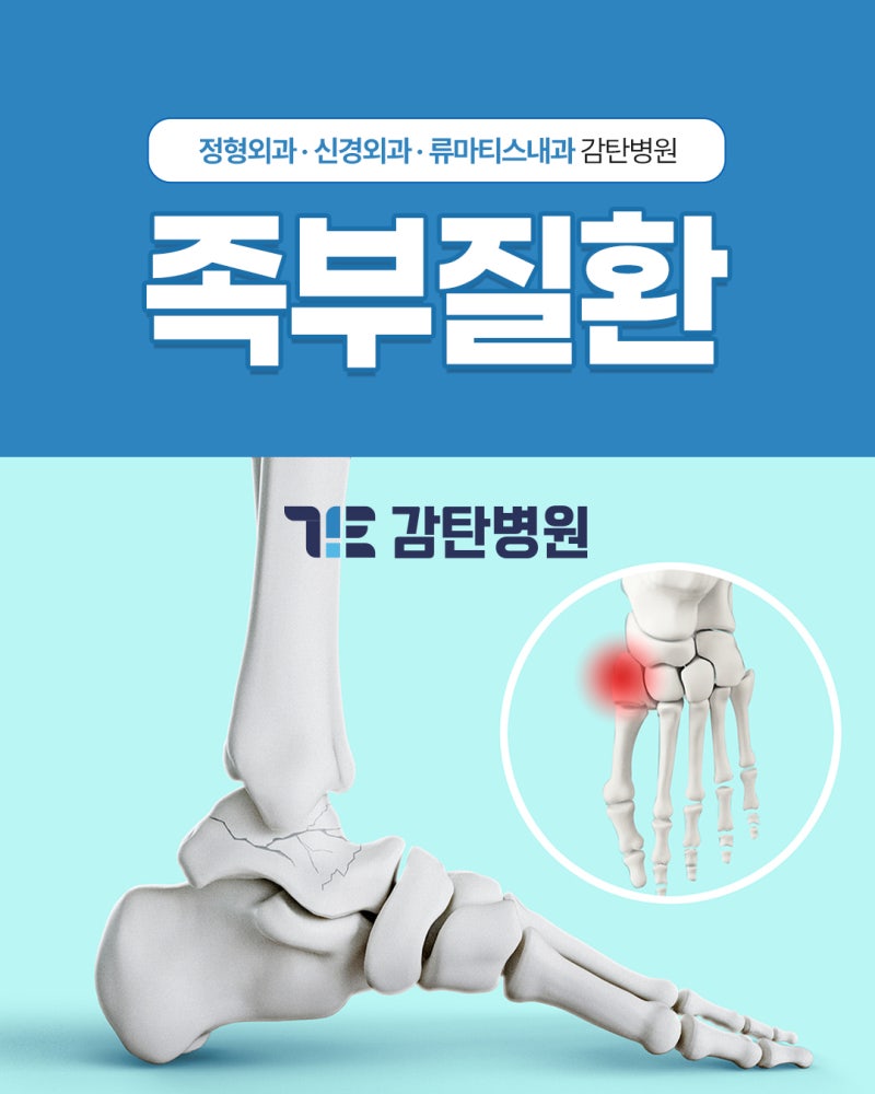 대전상대동정형외과 찾는다면? 발목 불안정부터 족저근막염·무지외반증까지