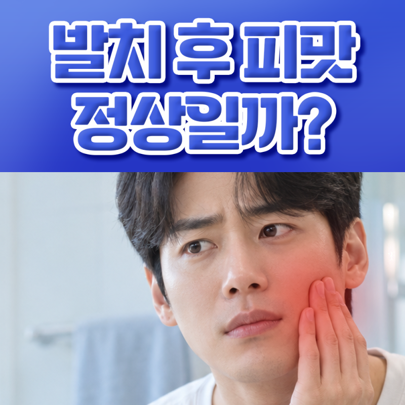 사랑니 발치 후 피맛, 정상일까요? 피해야 할 5가지