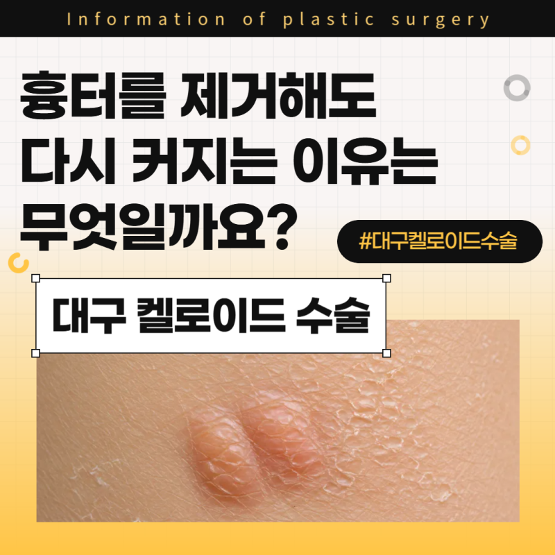 대구 켈로이드 수술, 흉터를 제거해도 다시 커지는 이유는 무엇일까요?