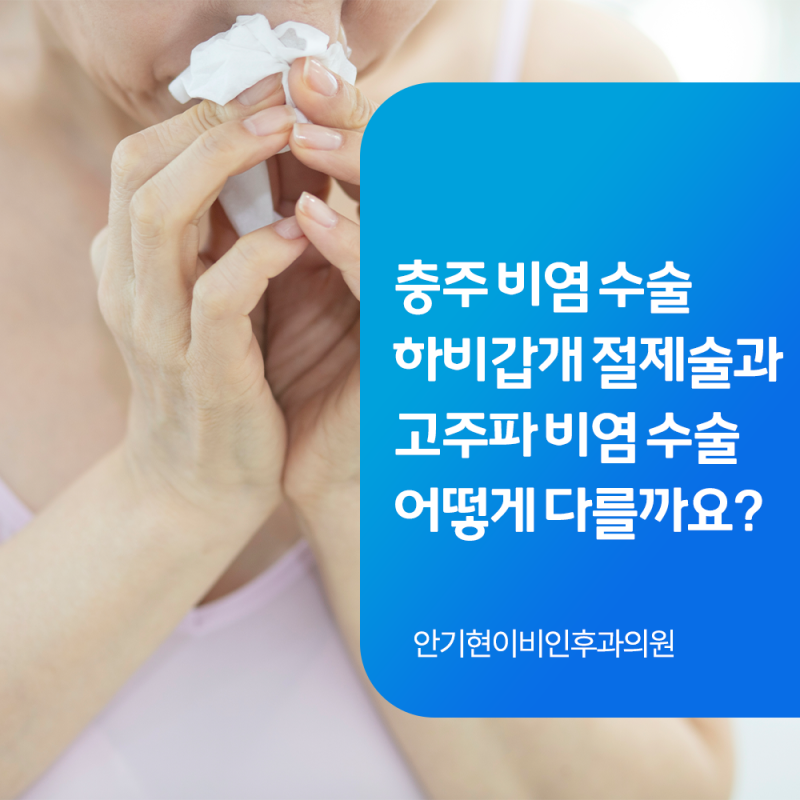 충주 비염 수술｜하비갑개 절제술과 고주파 비염 수술은 어떻게 다를까요?